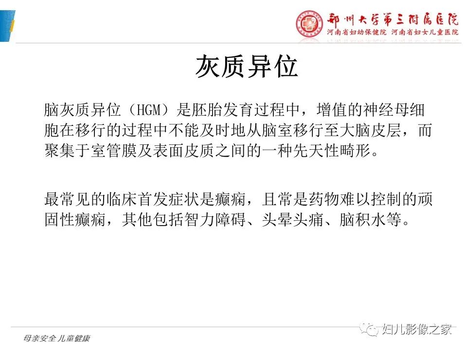 影像PPT - 【PPT】脑神经元移行异常（NMD）-7