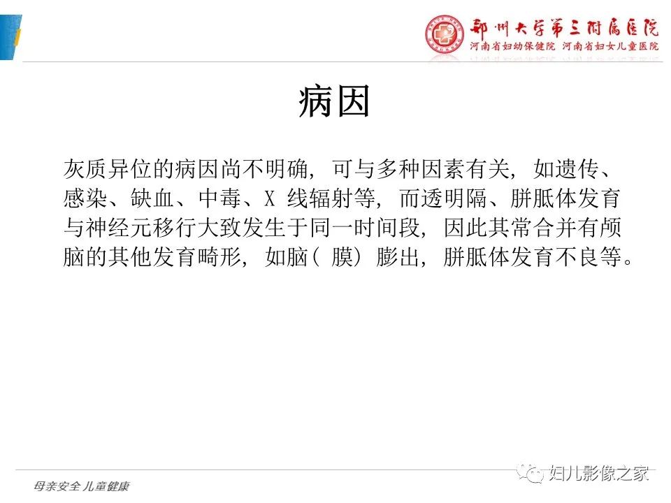 影像PPT - 【PPT】脑神经元移行异常（NMD）-4