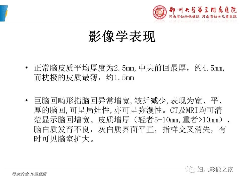 影像PPT - 【PPT】脑神经元移行异常（NMD）-20