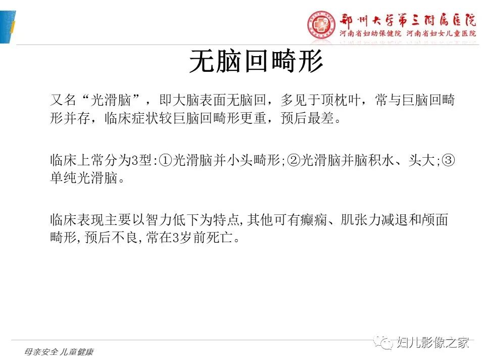 影像PPT - 【PPT】脑神经元移行异常（NMD）-22