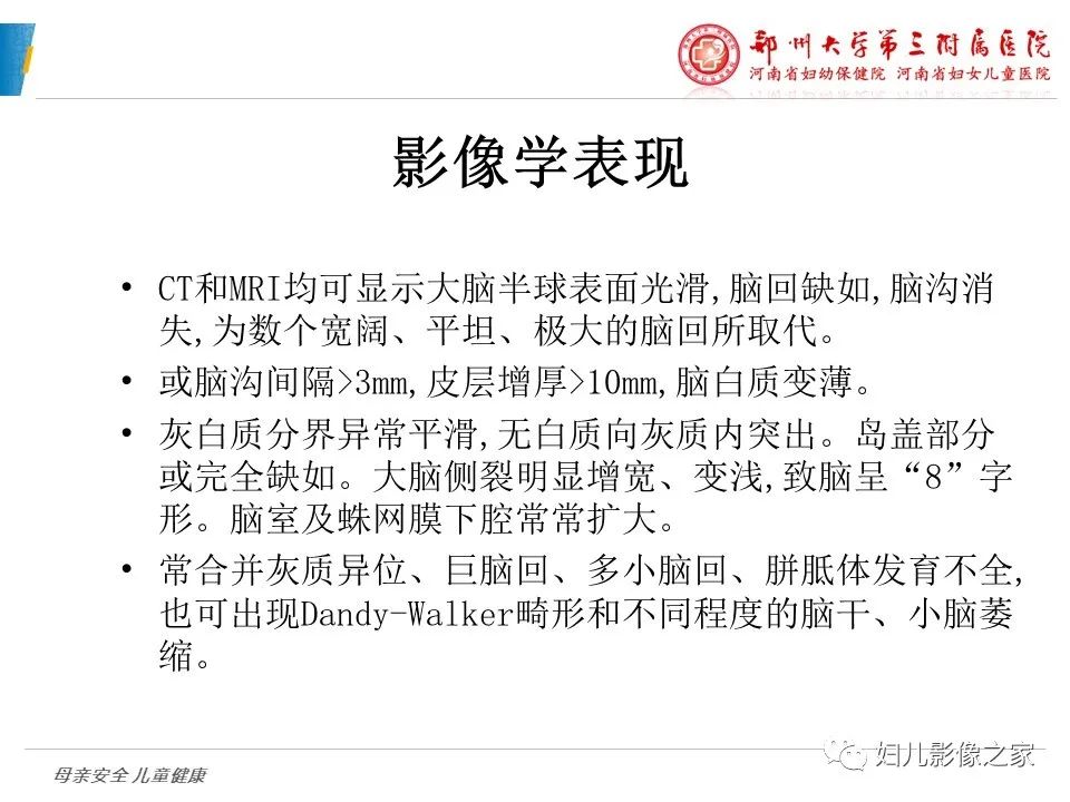 影像PPT - 【PPT】脑神经元移行异常（NMD）-23