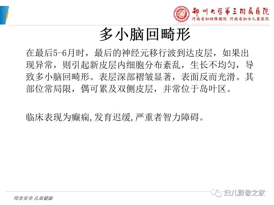 影像PPT - 【PPT】脑神经元移行异常（NMD）-25