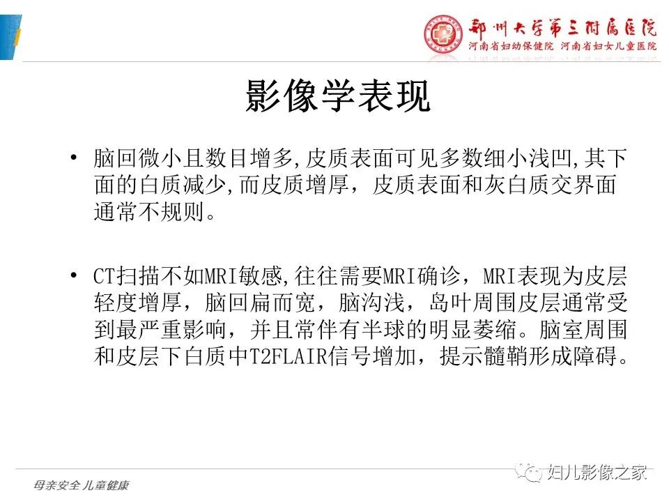影像PPT - 【PPT】脑神经元移行异常（NMD）-26