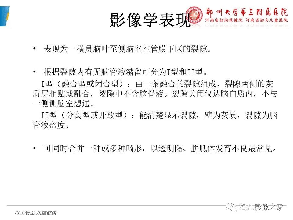 影像PPT - 【PPT】脑神经元移行异常（NMD）-29