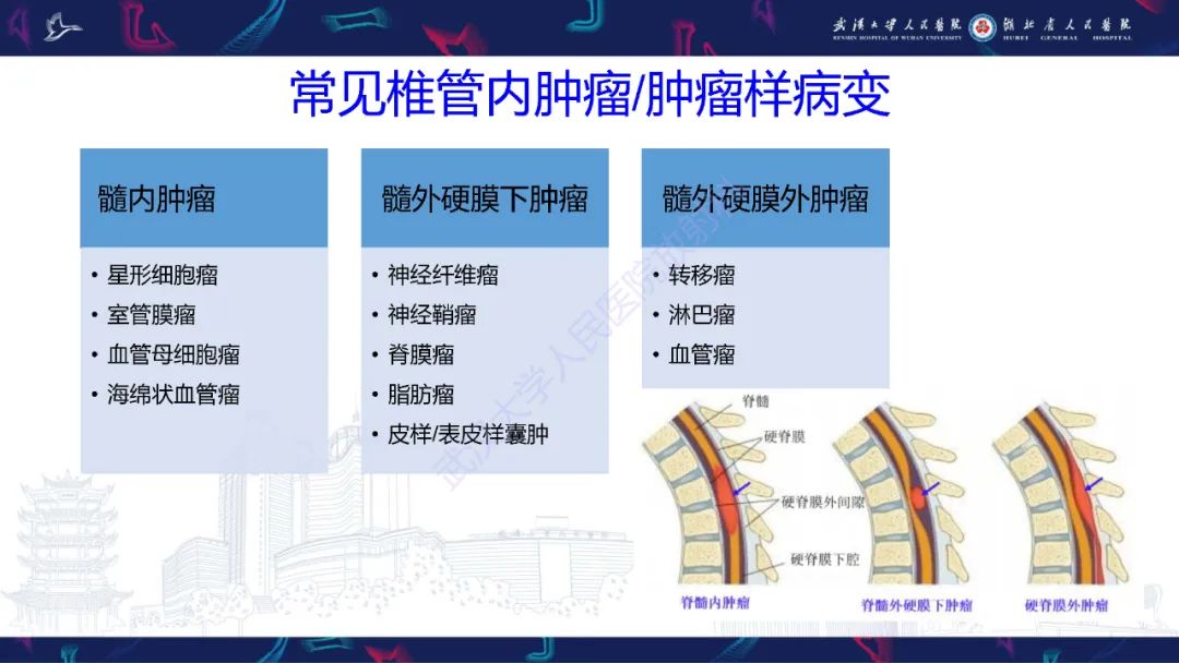 影像PPT - 【PPT】椎管内孤立性纤维瘤/血管外皮细胞瘤影像诊断-5