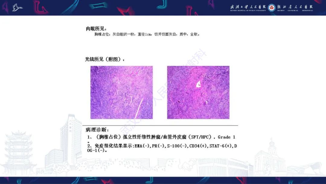 影像PPT - 【PPT】椎管内孤立性纤维瘤/血管外皮细胞瘤影像诊断-7