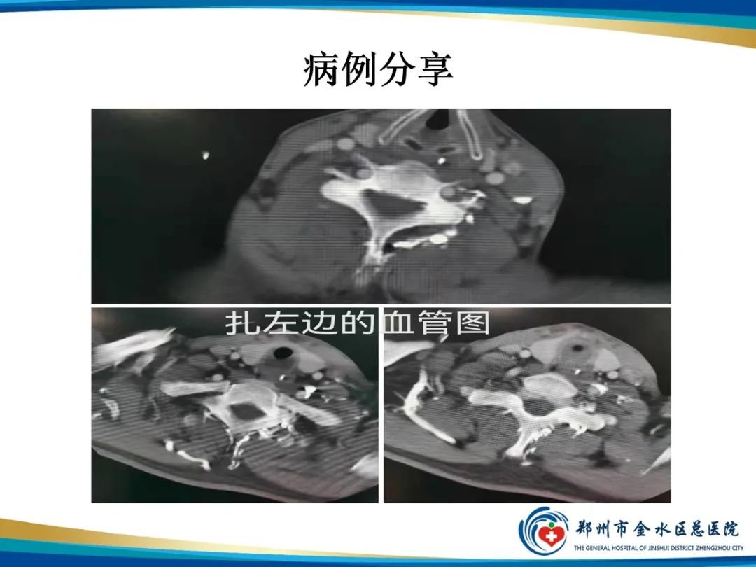 影像PPT - 【PPT】增强扎针时“左膀右臂”一样么？-6