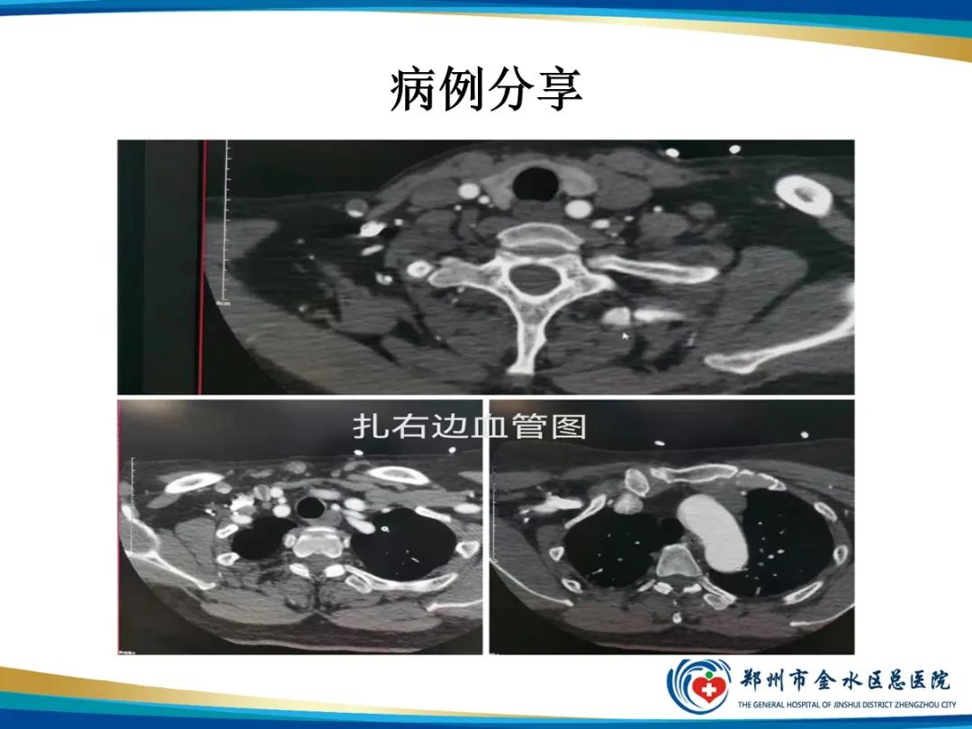 影像PPT - 【PPT】增强扎针时“左膀右臂”一样么？-5