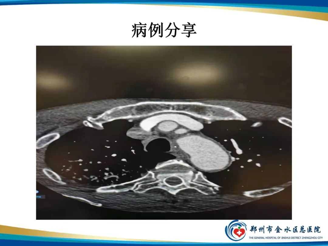 影像PPT - 【PPT】增强扎针时“左膀右臂”一样么？-7