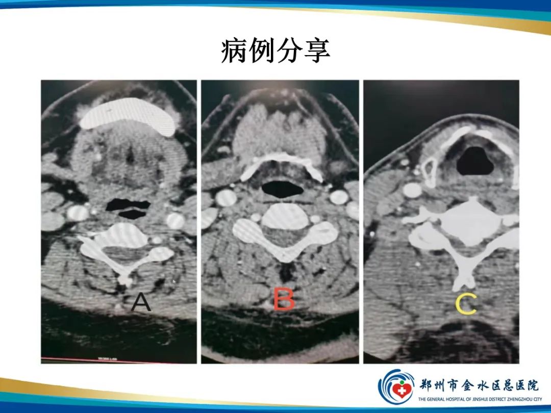 影像PPT - 【PPT】增强扎针时“左膀右臂”一样么？-10