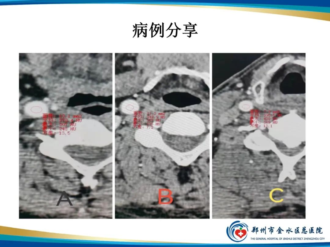 影像PPT - 【PPT】增强扎针时“左膀右臂”一样么？-11
