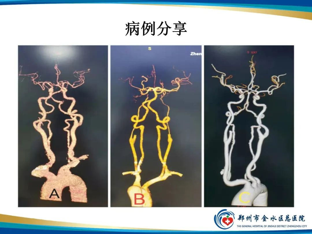 影像PPT - 【PPT】增强扎针时“左膀右臂”一样么？-12