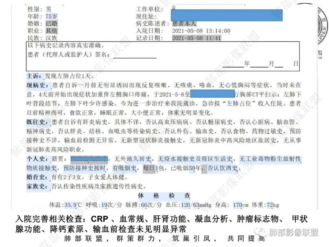 影像PPT - 【病例】看似“温和”的肺大细胞癌-2 影像PPT - 【病例】看似“温和”的肺大细胞癌-2