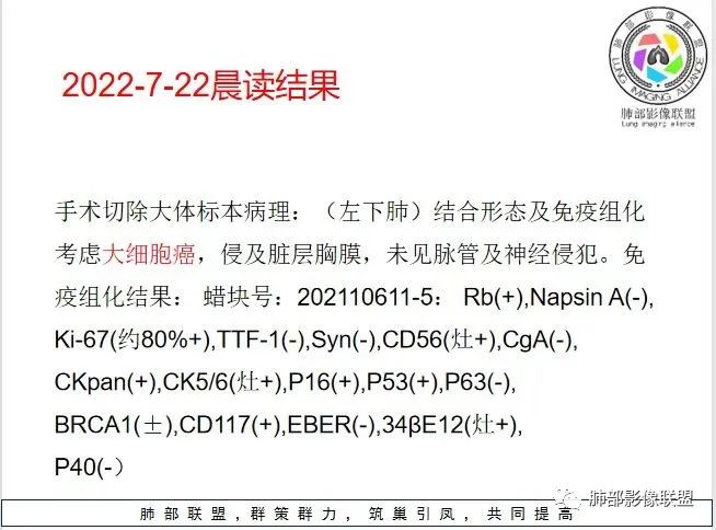 影像PPT - 【病例】看似“温和”的肺大细胞癌-25 影像PPT - 【病例】看似“温和”的肺大细胞癌-25
