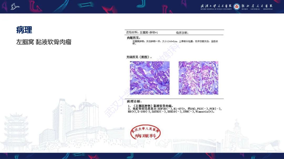 影像PPT - 【PPT】骨外粘液样软骨肉瘤影像诊断-4