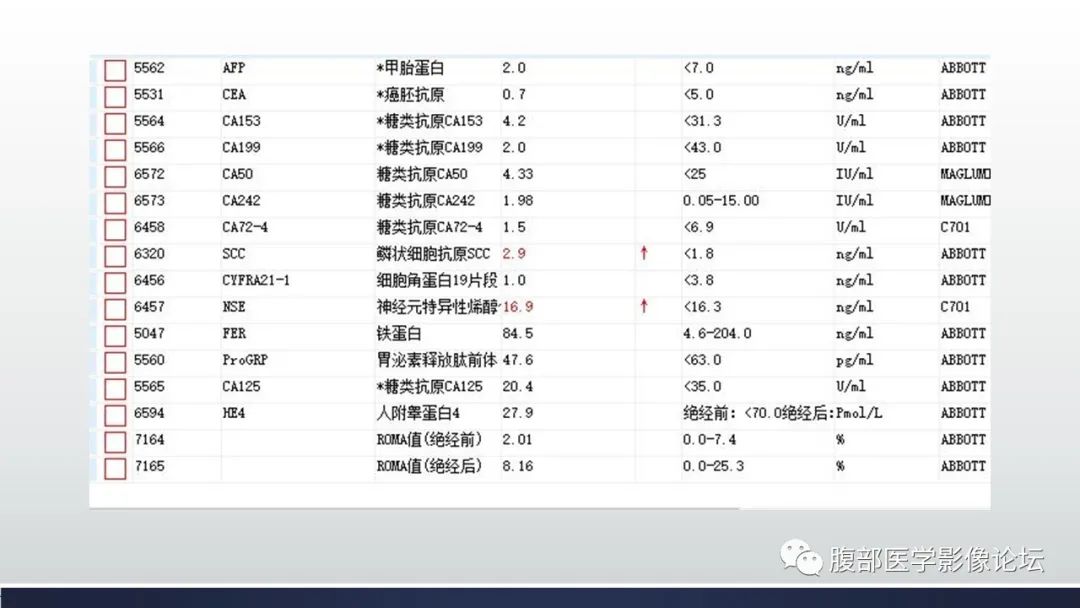 影像PPT - 【病例】卵巢颗粒细胞瘤3例影像-3