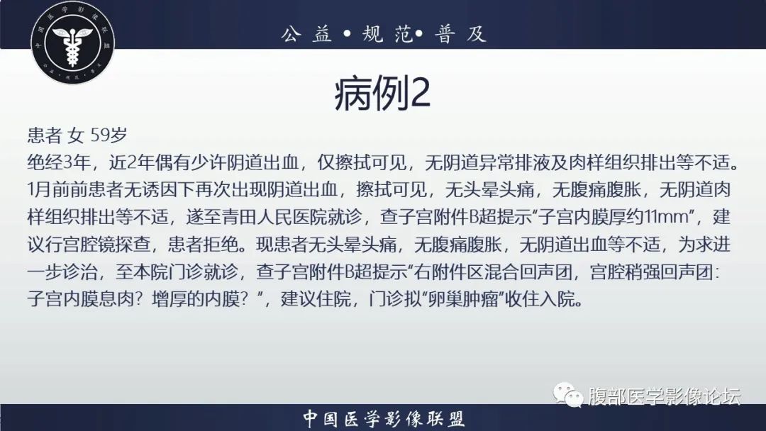 影像PPT - 【病例】卵巢颗粒细胞瘤3例影像-8