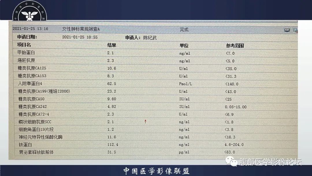 影像PPT - 【病例】卵巢颗粒细胞瘤3例影像-9