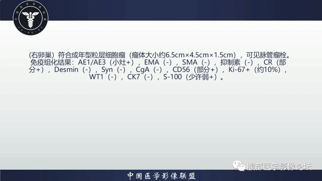 影像PPT - 【病例】卵巢颗粒细胞瘤3例影像-15