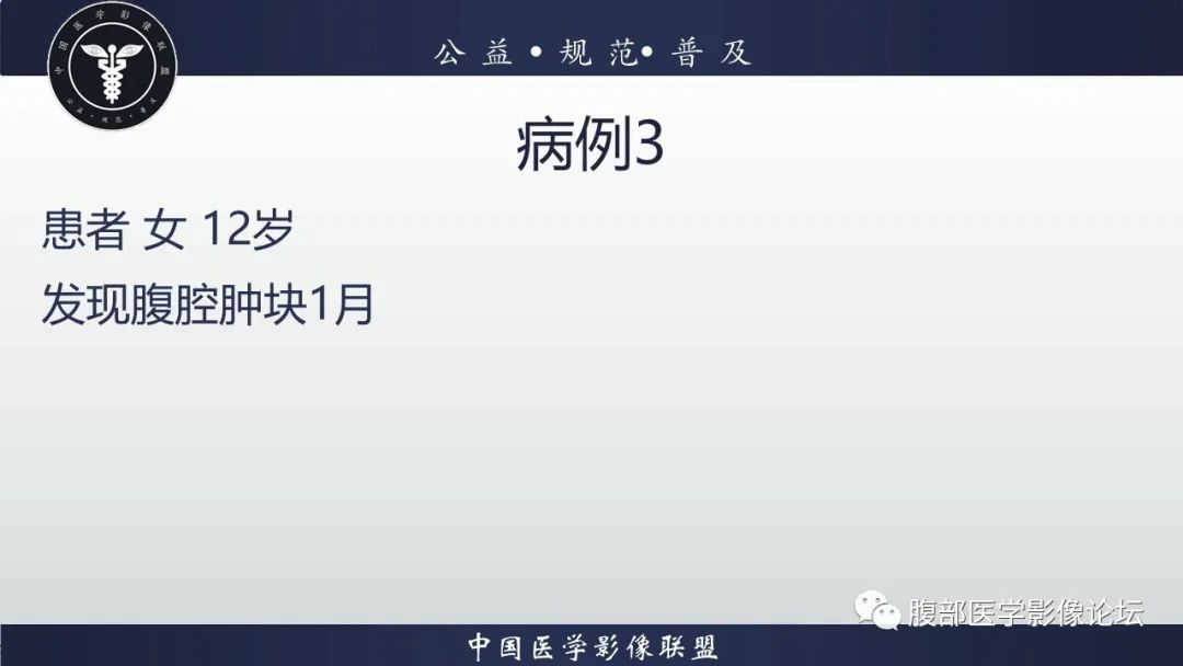 影像PPT - 【病例】卵巢颗粒细胞瘤3例影像-16