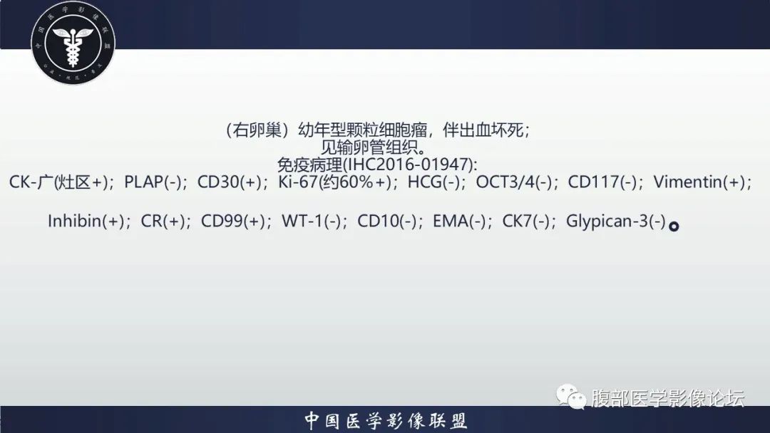 影像PPT - 【病例】卵巢颗粒细胞瘤3例影像-19