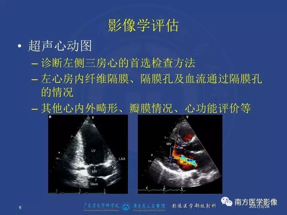 影像PPT - 【PPT】三房心（Cor triatiatum）-9