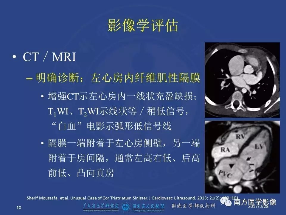 影像PPT - 【PPT】三房心（Cor triatiatum）-10