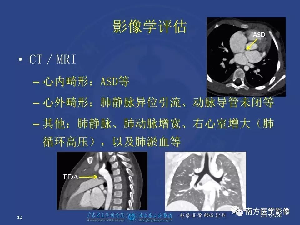 影像PPT - 【PPT】三房心（Cor triatiatum）-12