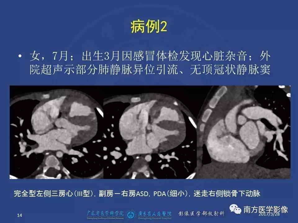 影像PPT - 【PPT】三房心（Cor triatiatum）-14