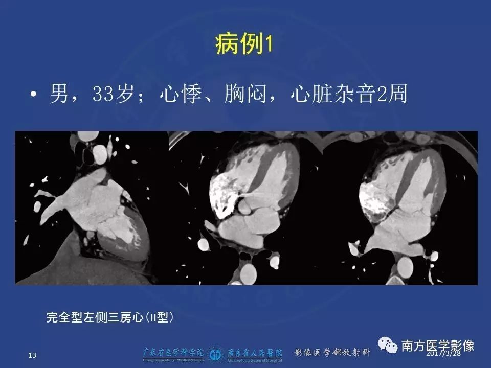 影像PPT - 【PPT】三房心（Cor triatiatum）-13