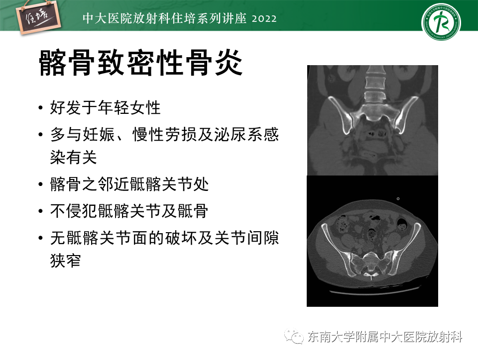 影像PPT - 【PPT】脊柱关节炎影像学评估-30
