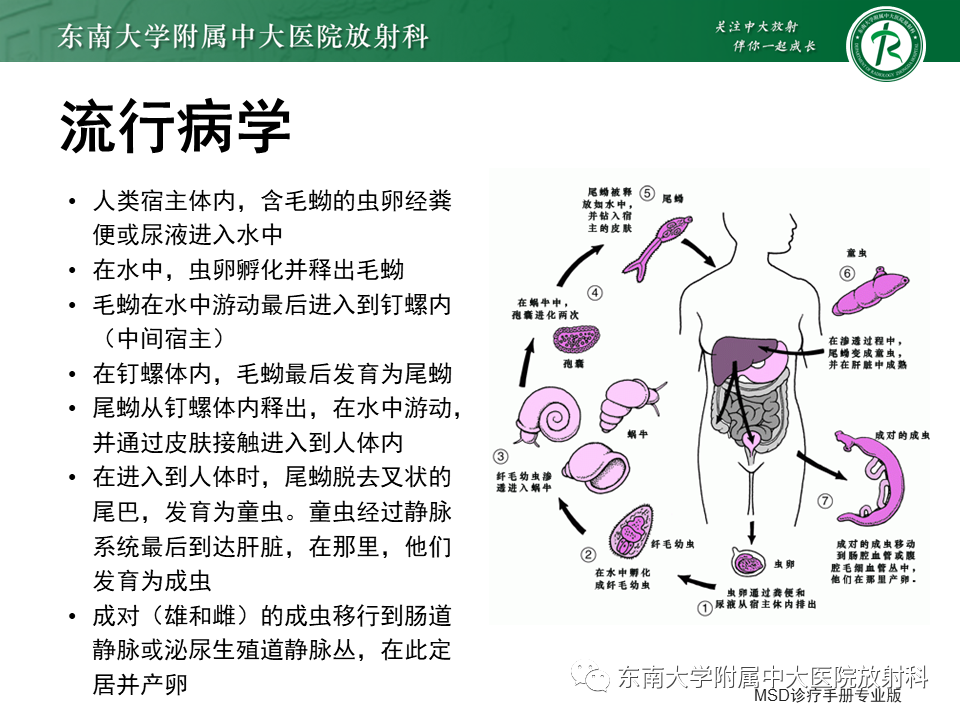 影像PPT - 【PPT】血吸虫肝病-7