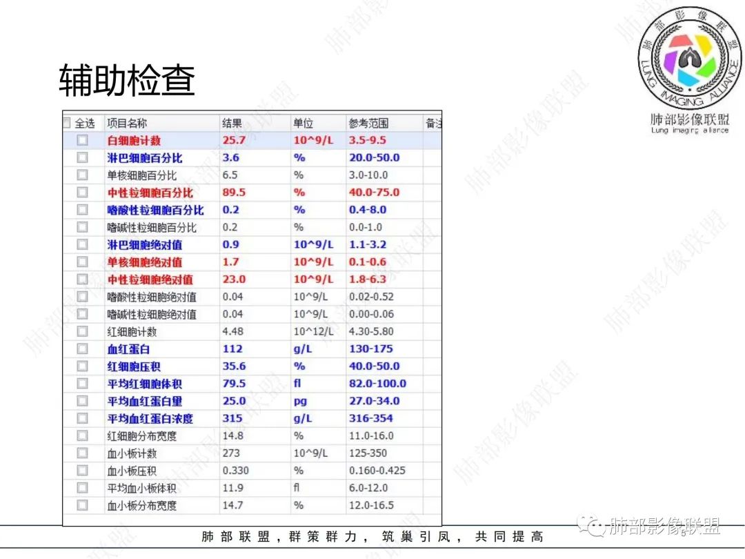 影像PPT - 【病例】肺曲霉菌病1例CT影像-5 影像PPT - 【病例】肺曲霉菌病1例CT影像-5