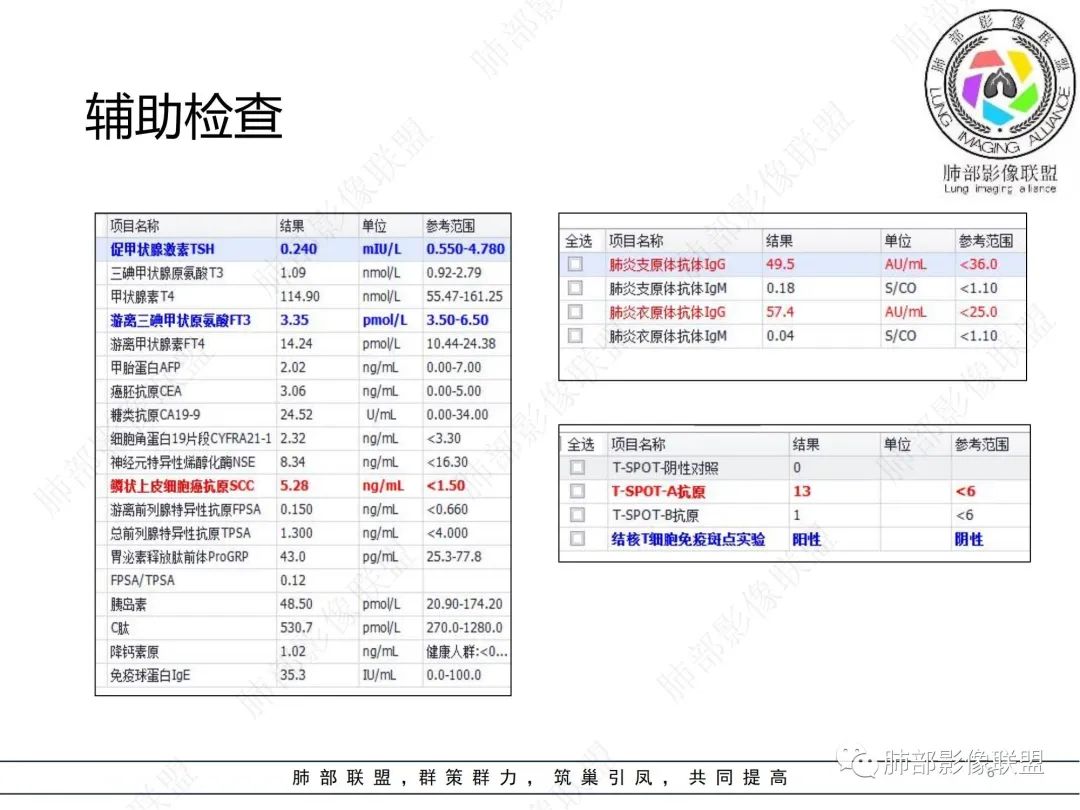 影像PPT - 【病例】肺曲霉菌病1例CT影像-6 影像PPT - 【病例】肺曲霉菌病1例CT影像-6