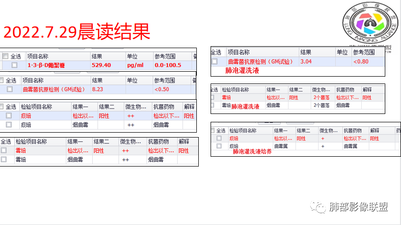 影像PPT - 【病例】肺曲霉菌病1例CT影像-56 影像PPT - 【病例】肺曲霉菌病1例CT影像-56