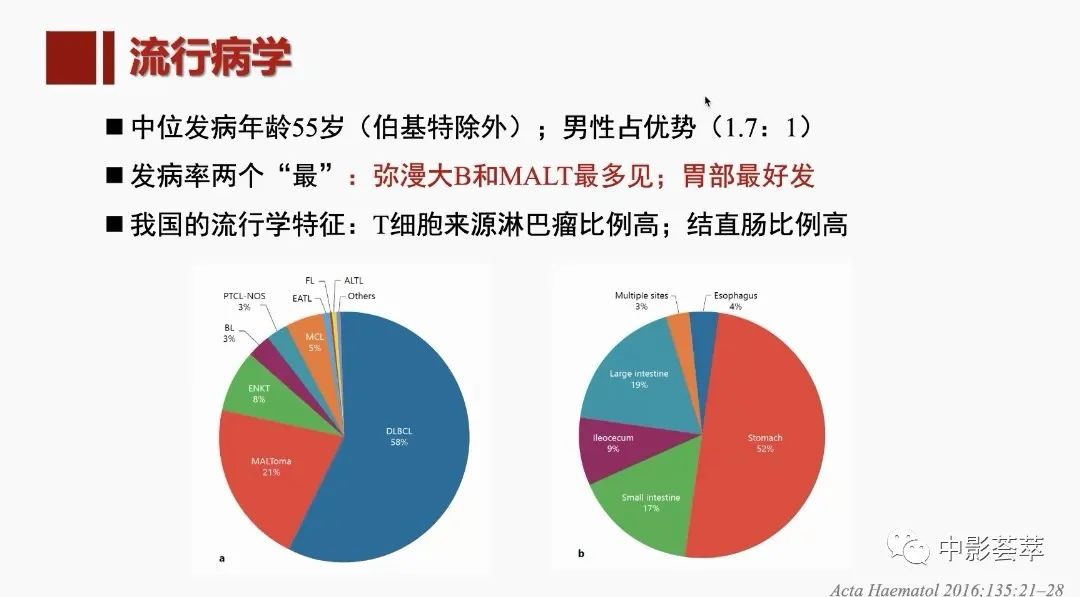 影像PPT - 【PPT】胃肠淋巴瘤及小肠肿瘤性的病变综述-6