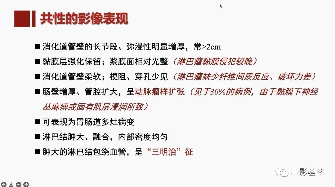 影像PPT - 【PPT】胃肠淋巴瘤及小肠肿瘤性的病变综述-9