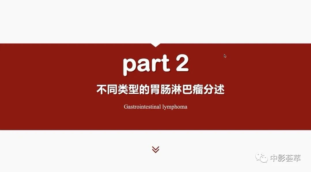 影像PPT - 【PPT】胃肠淋巴瘤及小肠肿瘤性的病变综述-14