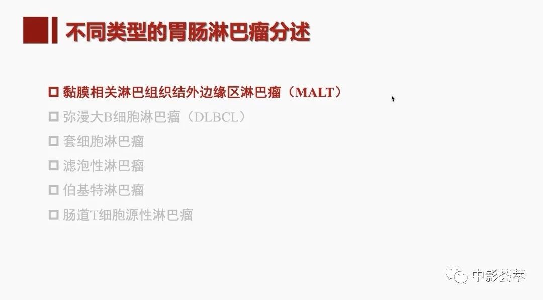 影像PPT - 【PPT】胃肠淋巴瘤及小肠肿瘤性的病变综述-15
