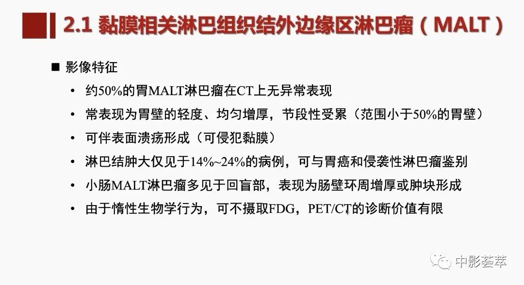影像PPT - 【PPT】胃肠淋巴瘤及小肠肿瘤性的病变综述-19