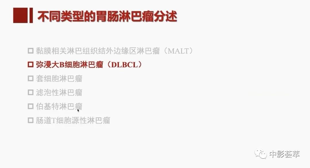影像PPT - 【PPT】胃肠淋巴瘤及小肠肿瘤性的病变综述-23