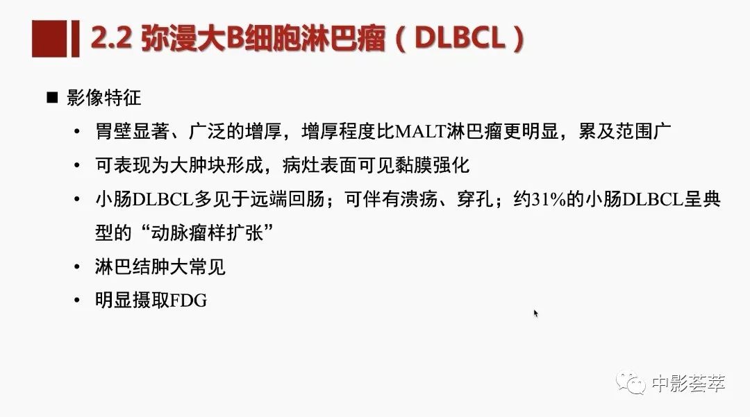 影像PPT - 【PPT】胃肠淋巴瘤及小肠肿瘤性的病变综述-25