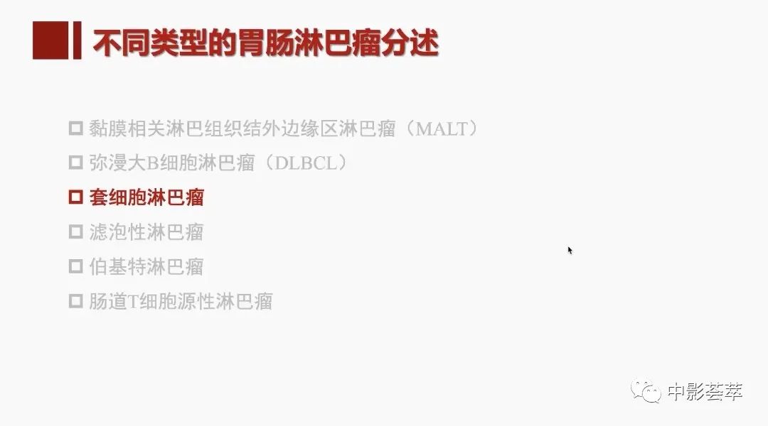 影像PPT - 【PPT】胃肠淋巴瘤及小肠肿瘤性的病变综述-30
