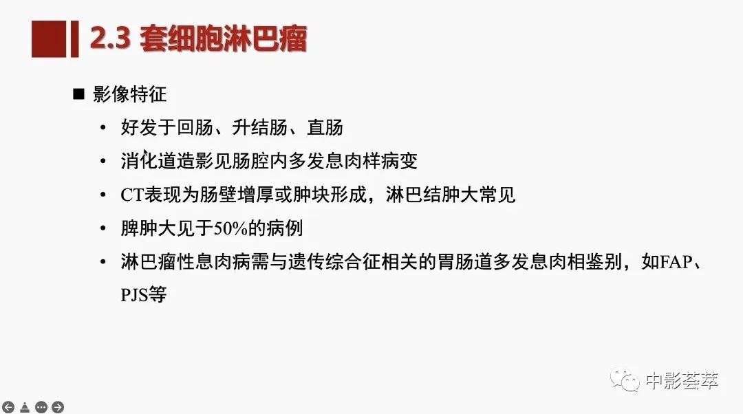 影像PPT - 【PPT】胃肠淋巴瘤及小肠肿瘤性的病变综述-31