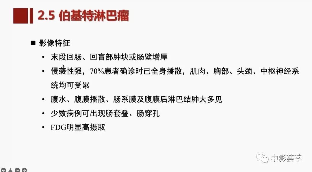 影像PPT - 【PPT】胃肠淋巴瘤及小肠肿瘤性的病变综述-39