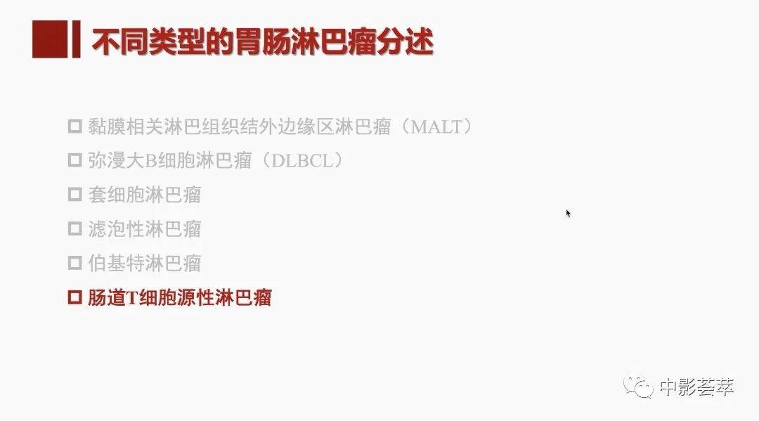 影像PPT - 【PPT】胃肠淋巴瘤及小肠肿瘤性的病变综述-42