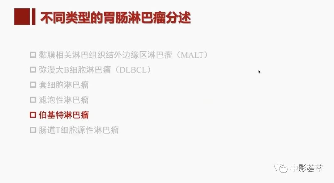 影像PPT - 【PPT】胃肠淋巴瘤及小肠肿瘤性的病变综述-38