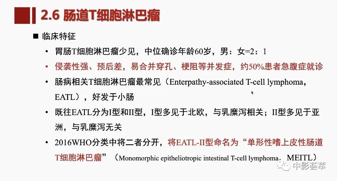 影像PPT - 【PPT】胃肠淋巴瘤及小肠肿瘤性的病变综述-43