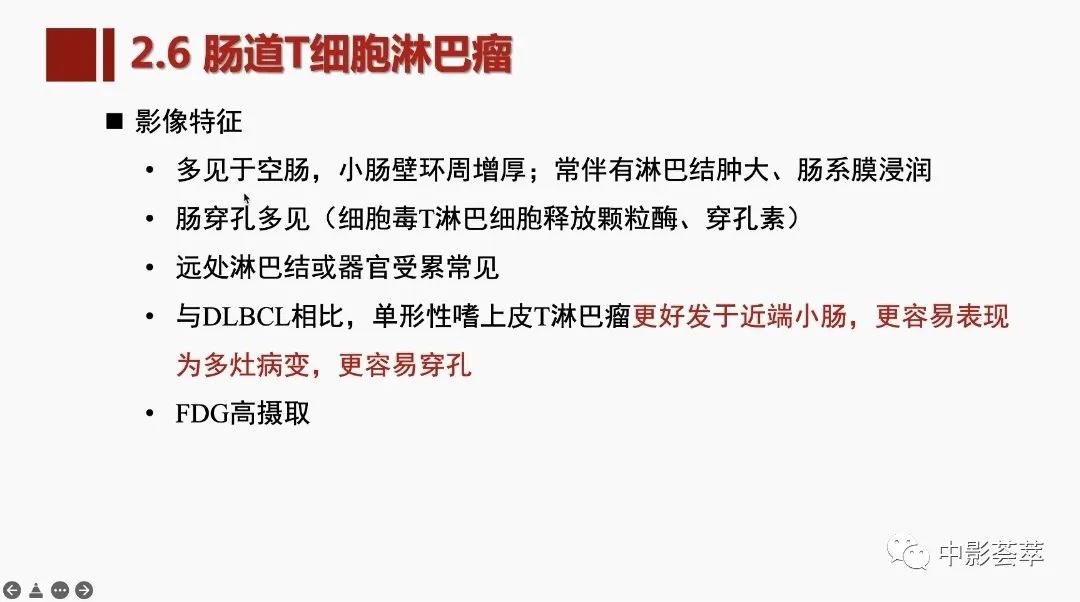 影像PPT - 【PPT】胃肠淋巴瘤及小肠肿瘤性的病变综述-45
