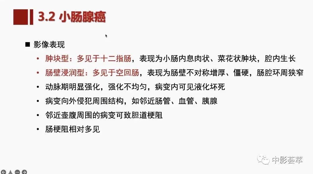 影像PPT - 【PPT】胃肠淋巴瘤及小肠肿瘤性的病变综述-53